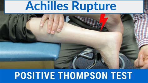 achilles tear testing|thompson test positive or negative.